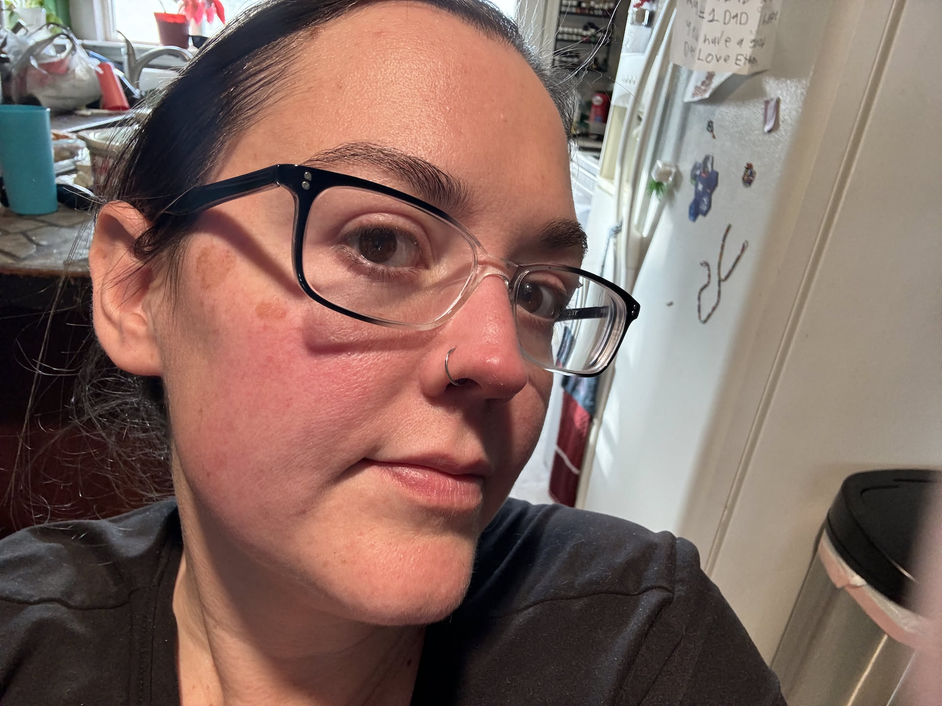 Deanna ate some guava and got all flush afterwards… we are hoping it was working so hard at cooking and not that she is allergic.