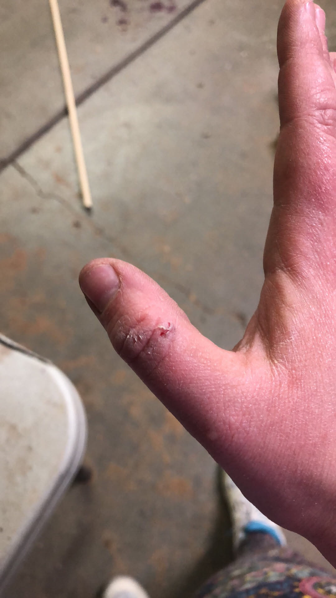 Ouch… she got hurt in the process.